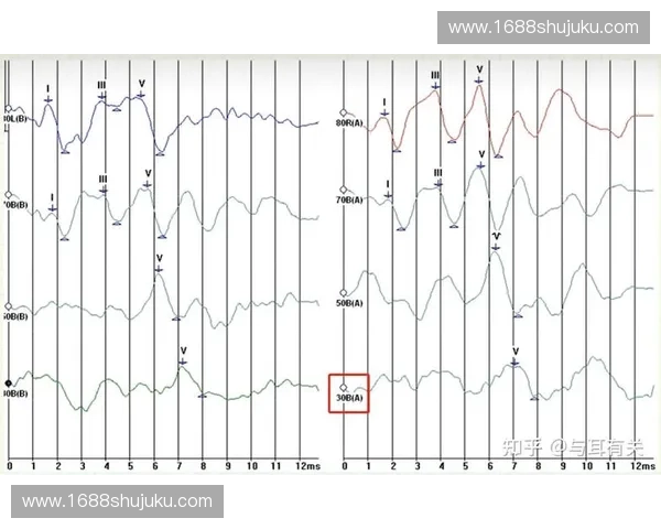 基于多种刺激模式的反应时测定与分析方法研究